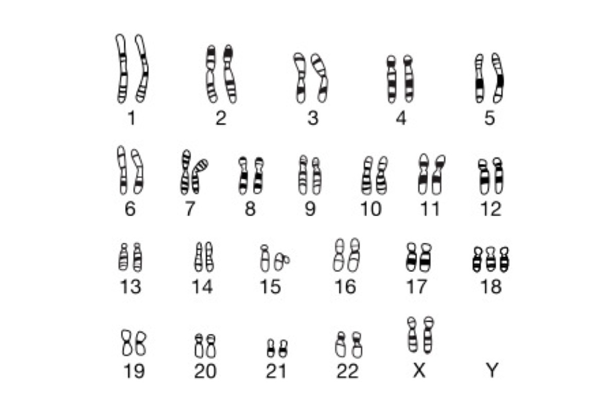 <p>The karyotype of an individual with trisomy 18 is represented in the figure. Which of the following errors would have occurred in one of the individual’s parents to have resulted in trisomy 18</p>