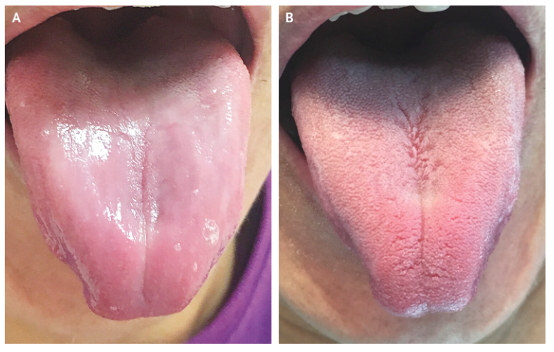 <p>right condition</p>