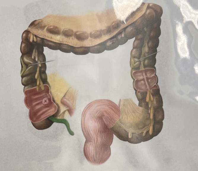 term image