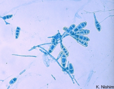 <p>Beaver tailed macroconidia</p>