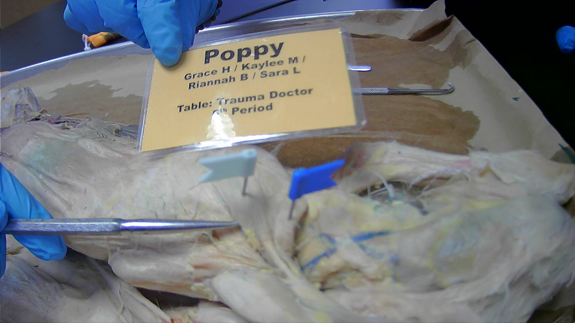 <p>What muscle is the blue flag? </p>