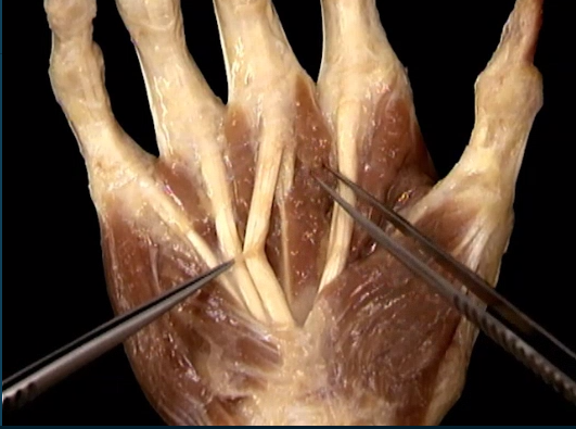 <p>Diepr, handpalm</p>