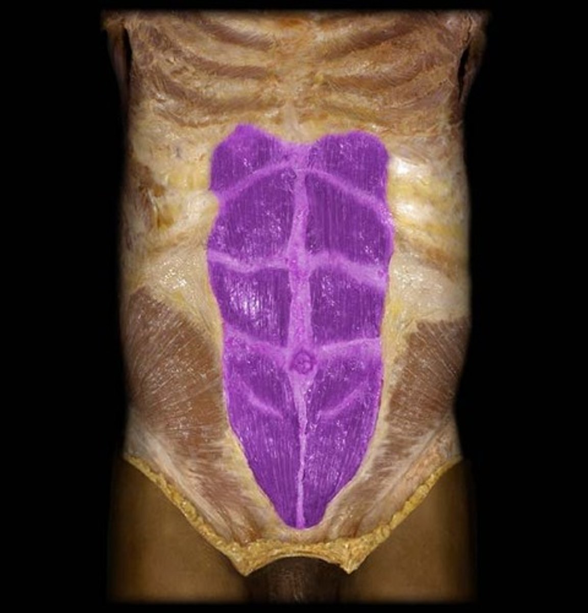 <p>Pubic crest, pubic tubercle, and pubic symphysis</p>