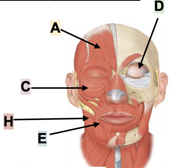<p>A</p>