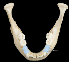 <p>The teeth immediately behind the canines; used in chewing/ grinding food (bicuspid teeth)</p>