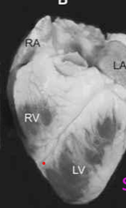 <p>what heart is this</p>