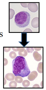 <p>Lymphocytosis</p>