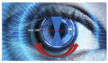 <p>With an axis near 180°, the thicker meridian is approximately perpendicular to the upper eyelid.<br>The eyelid can push against the thicker vertical lens profile, creating rotation that may be either temporal or nasal depending on eye/lid interactions.</p>