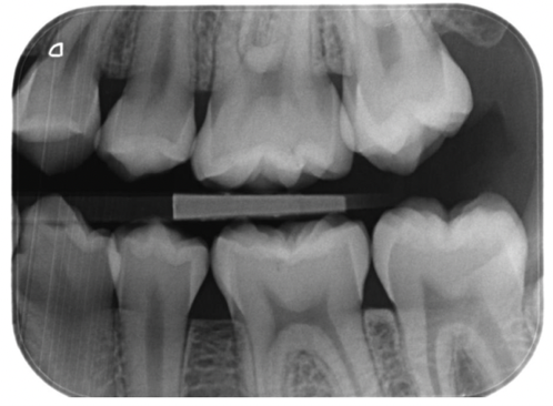 <p><span style="font-family: Calibri, sans-serif;">&nbsp;</span></p><p><span style="font-family: Calibri, sans-serif; line-height: 115%;"><strong>Er optagelsen ortoradial? Begrund dit svar</strong></span></p>