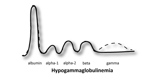 <p>DECREASED gamma</p><p><strong>Think any immune deficiency of gamma globulins (IgG,IgA,IgM)</strong></p>