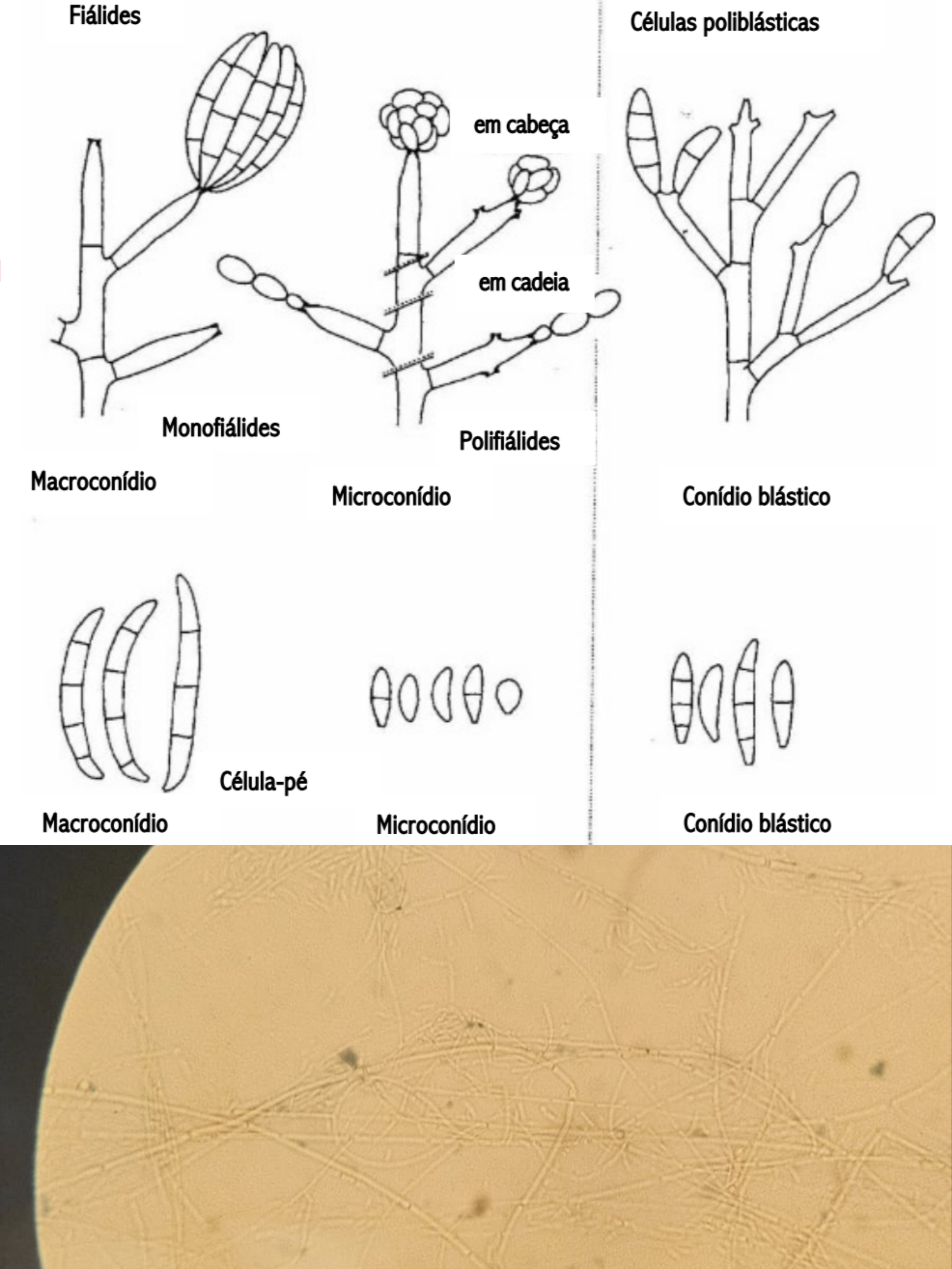 <p>Indica:</p><p class="has-focus">Se é fungo filamentoso inferior ou superior</p><p class="has-focus">O gênero do fungo</p><p class="has-focus">Características que o distingue</p>