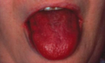 <p>what is this condition  </p>