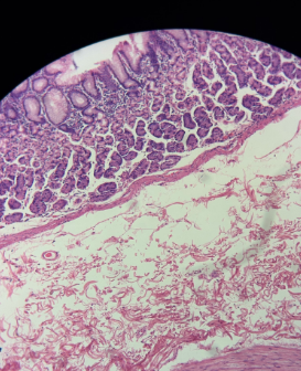 <p>-Human Stomach (fundis)</p><p>-The image on the back is a mammal stomach<br>-Parietal cells (make HCl, eosinophilic cytoplasm)</p><p>-Chief cells (make pepsinogen, basoohilic cytoplasm)</p>