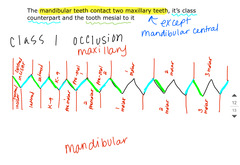 <p>The arrangement where mandibular teeth contact two maxillary teeth, including the class counterpart and the tooth mesial to it</p>