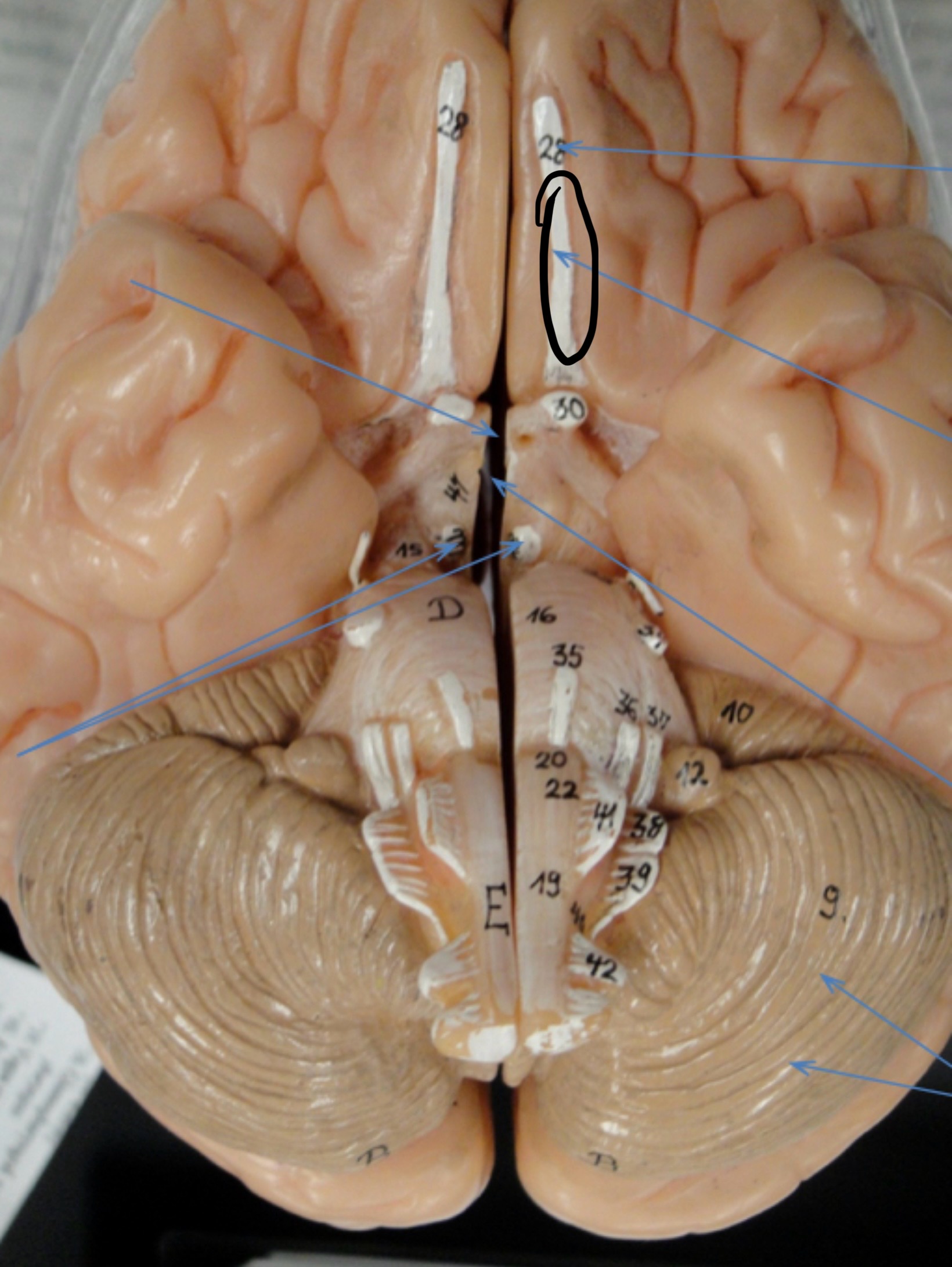 <p>Identify the circled area?</p>