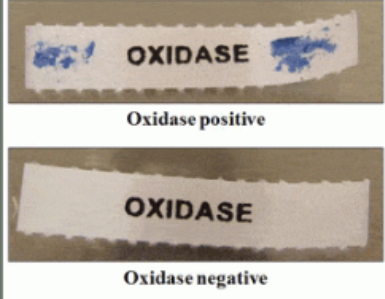 <p>TSA Oxidase positive result?</p>