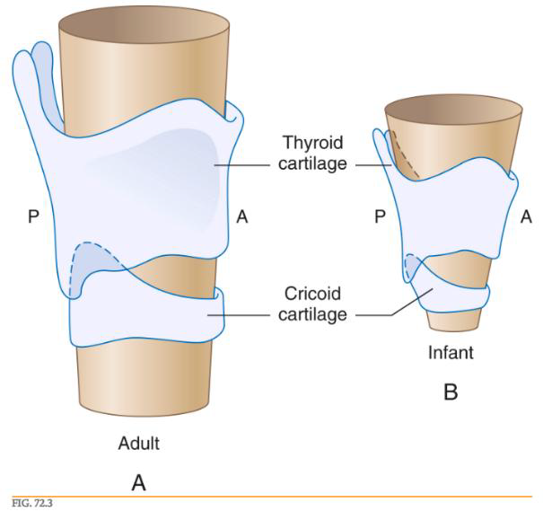 <p>답: A</p><p>소아의 larynx는 경부에서 더 cephalad위치에 있고 funnel shape(깔대기모양) (성인은 실린더모양이다), epiglottis는 더 짧고 omega shape. cricoid cartialge, 혹은 subglottic region에서 narrowest한 경우가 많아 ETT가 끼일수있다.</p>