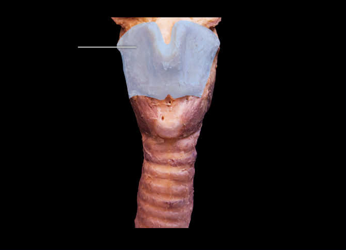 <p><span>Identify the highlighted respiratory structure (anterior view).</span></p><p></p><p>cricoid cartilage</p><p> </p><p>thyroid cartilage</p><p> </p><p>pharynx</p><p> </p><p>tracheal cartilage</p>
