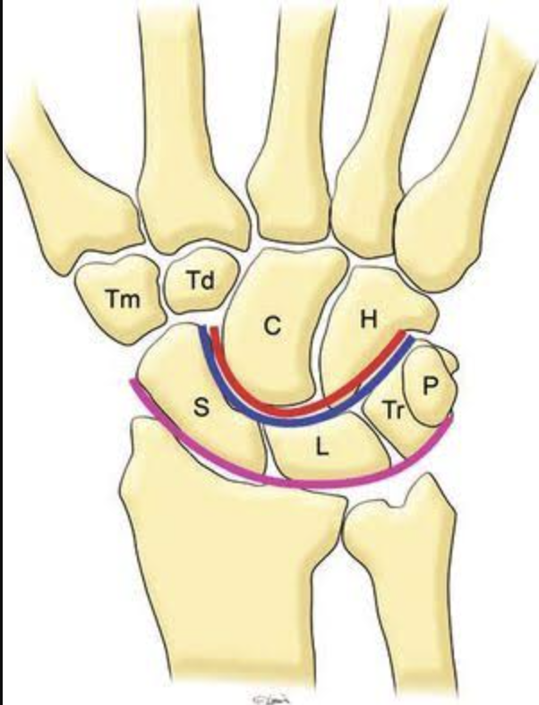 <p>What is <strong>TD </strong>of <strong>distal carpals</strong> is this?</p>