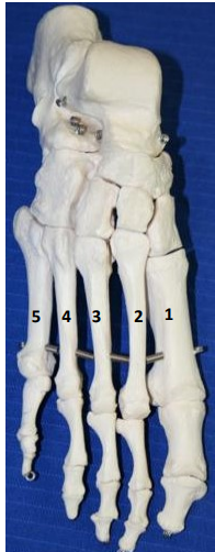<p>What bone is this? What view of the bone is this?</p>