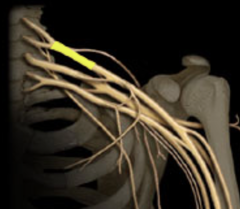 <p>Identify the structure</p>