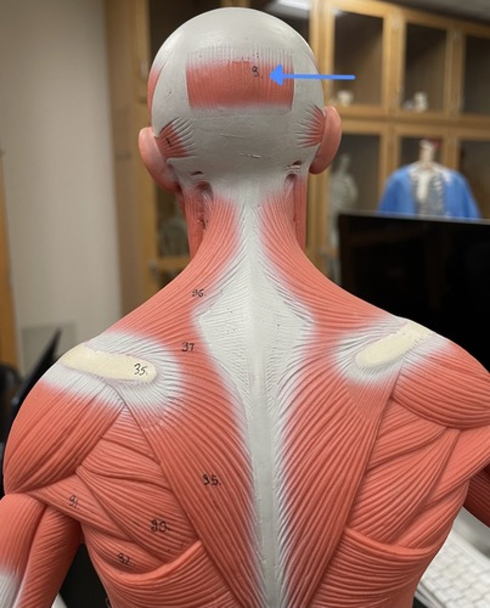 <p>occipital belly </p><p>origin:</p><p>insertion: </p><p>action: </p>