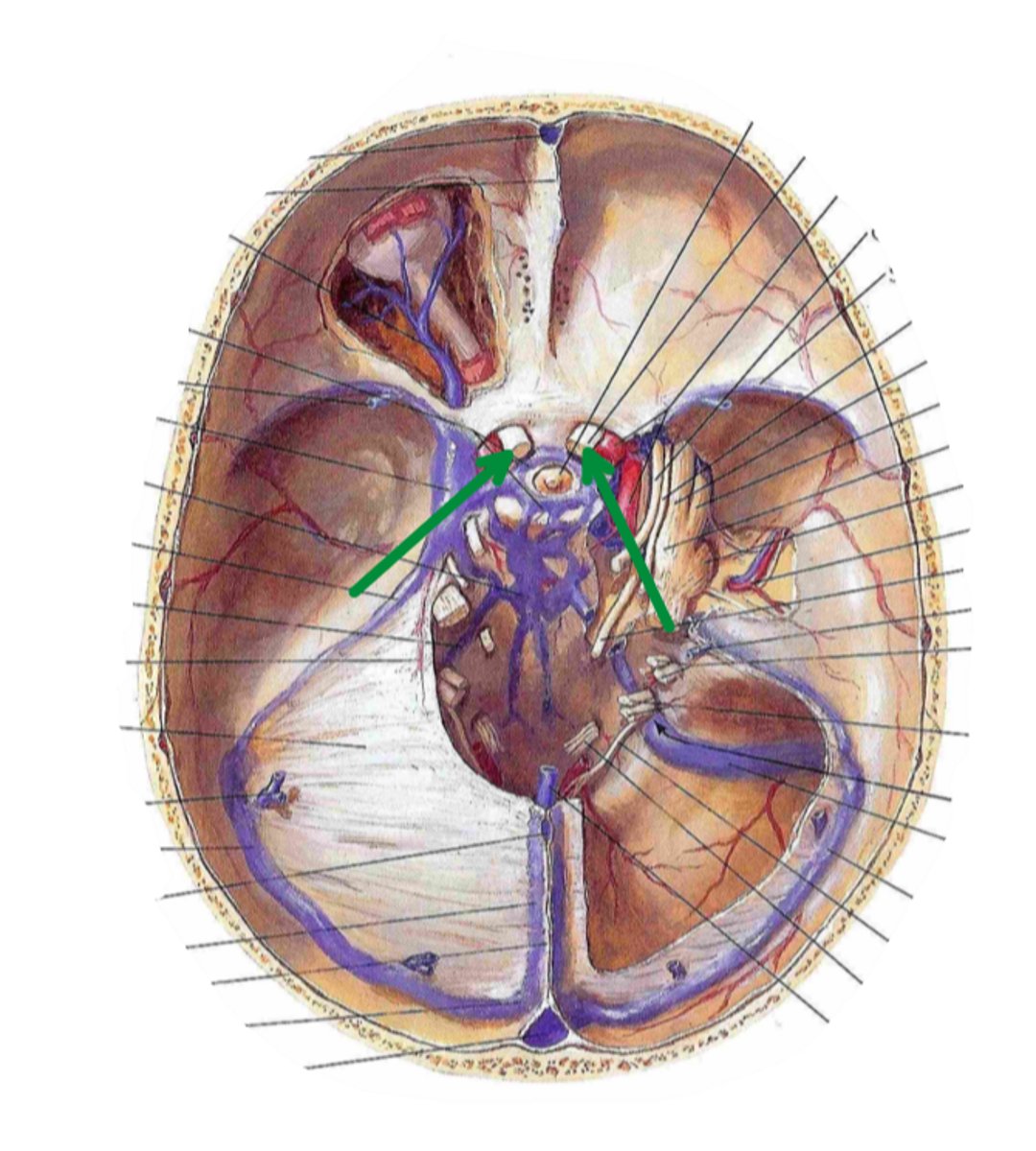 <p>Identify the structure indicated by the arrow</p>