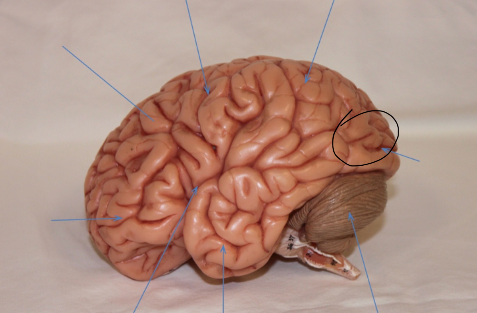 <p>Identify the circled area?</p>