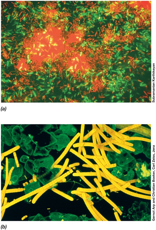 <ul><li><p><em>using computerised fluorescent microscope coupled with laser source to make a 3D image </em></p></li><li><p><em>focus on single layers of specimen </em></p></li><li><p><em>3D image can be made</em></p></li></ul><p></p>