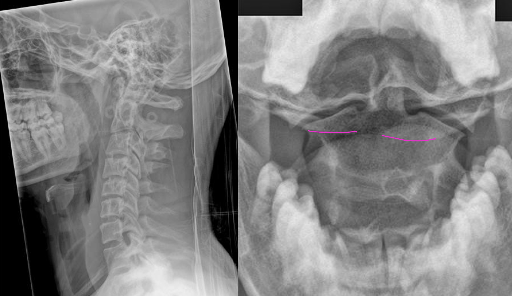 <p>What is the dx</p>