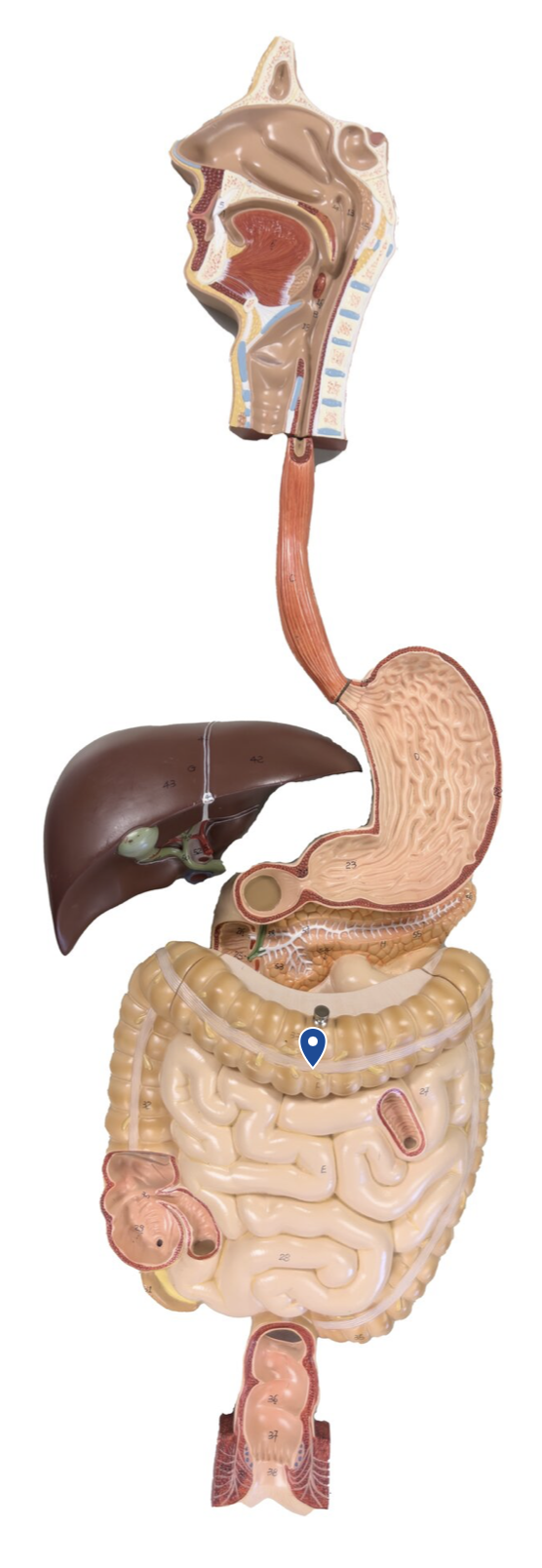 <p>Name this segment of the large intestine.</p>