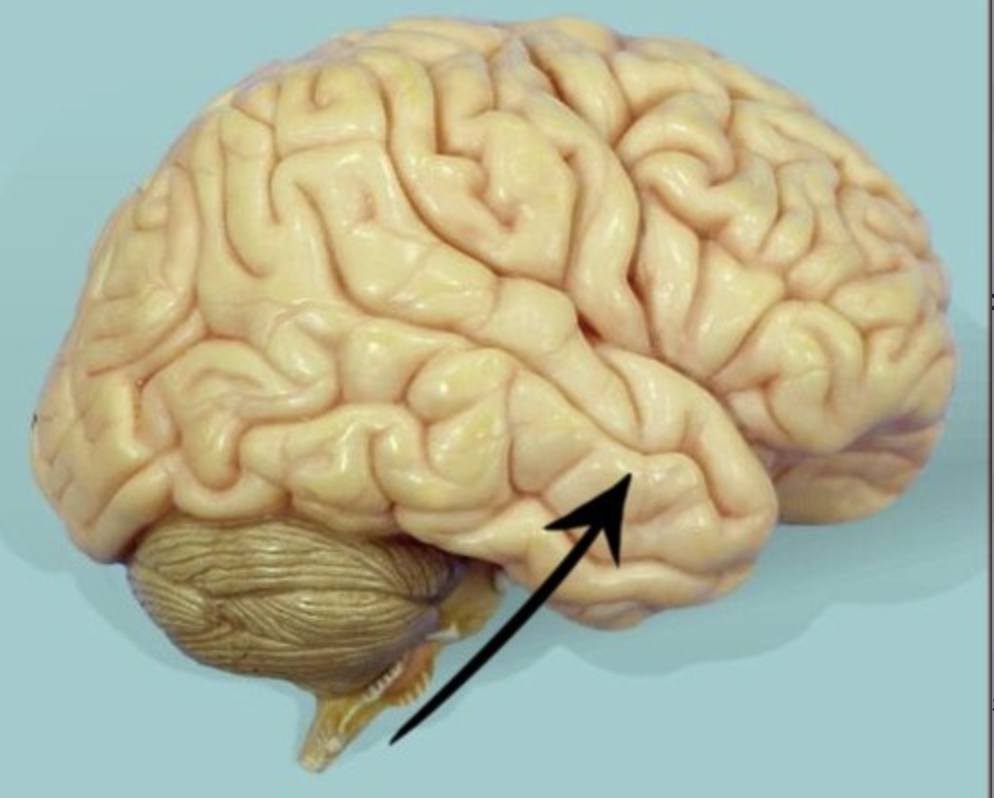 <p>location of auditory cortex, olfactory cortex, Wernicke’s area</p>