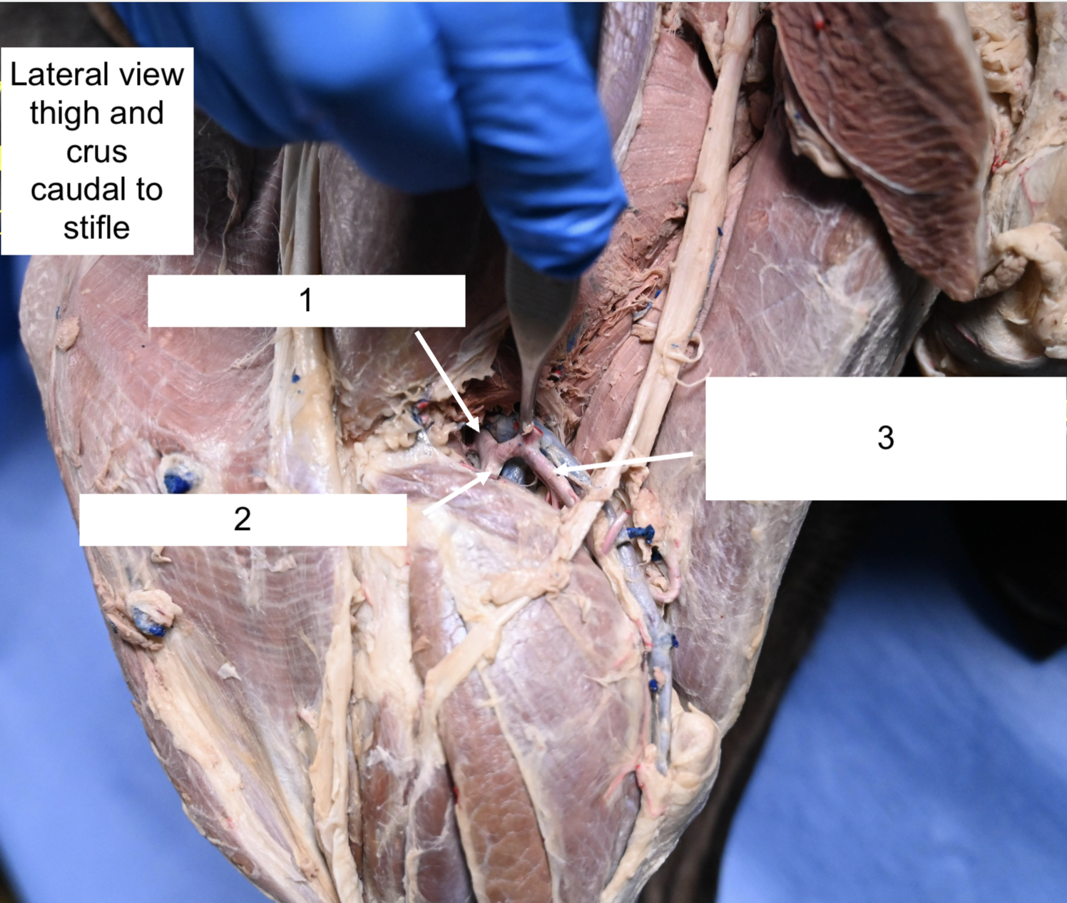<p>What artery is 1?</p>