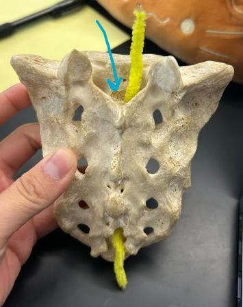 <p>ID sacrum/coccyx hole region</p>