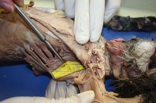 <p>Subscapularis</p>