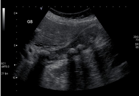 <p>What pathology is this</p>