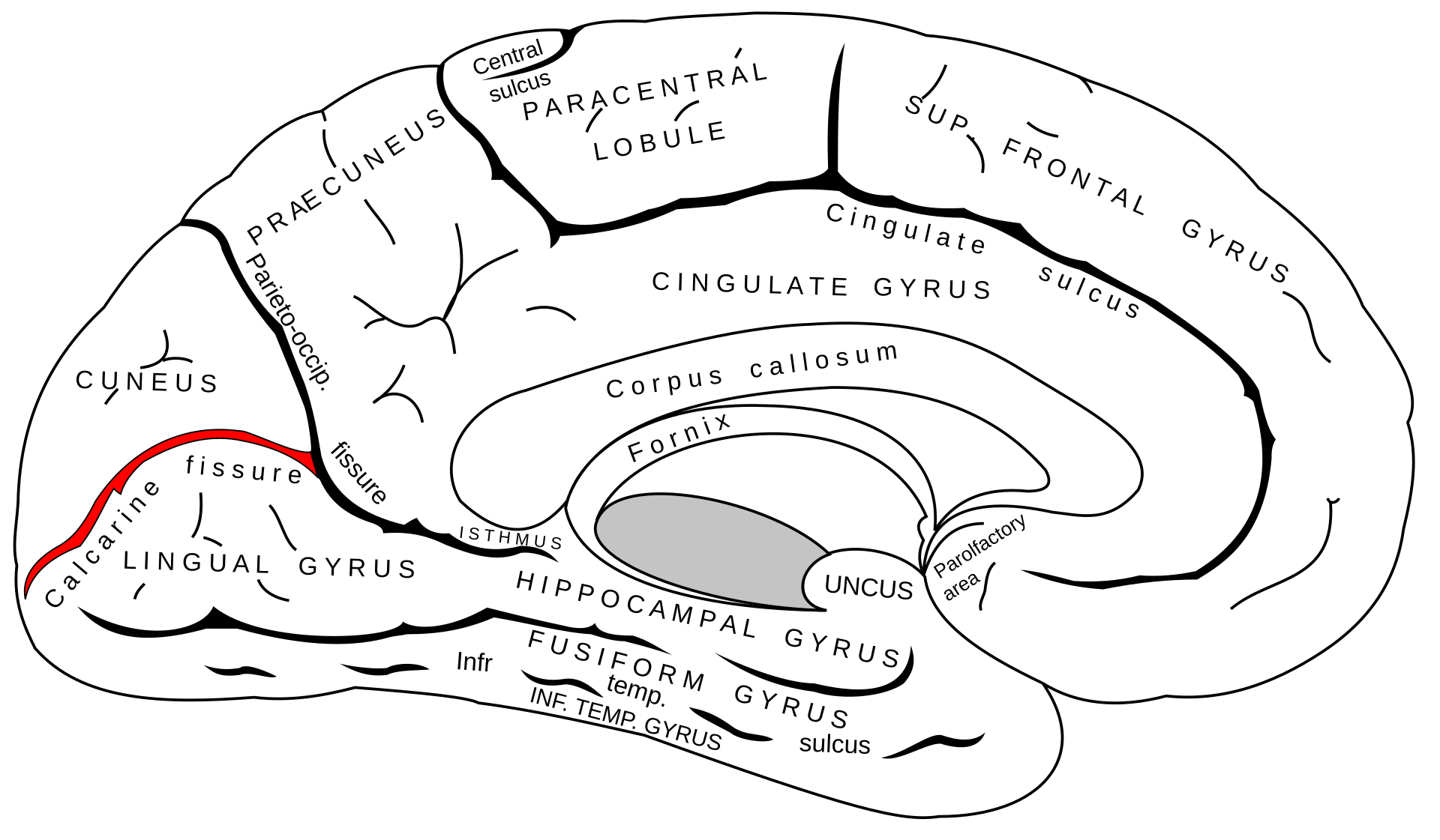 <p>Calcarine Fissure </p>
