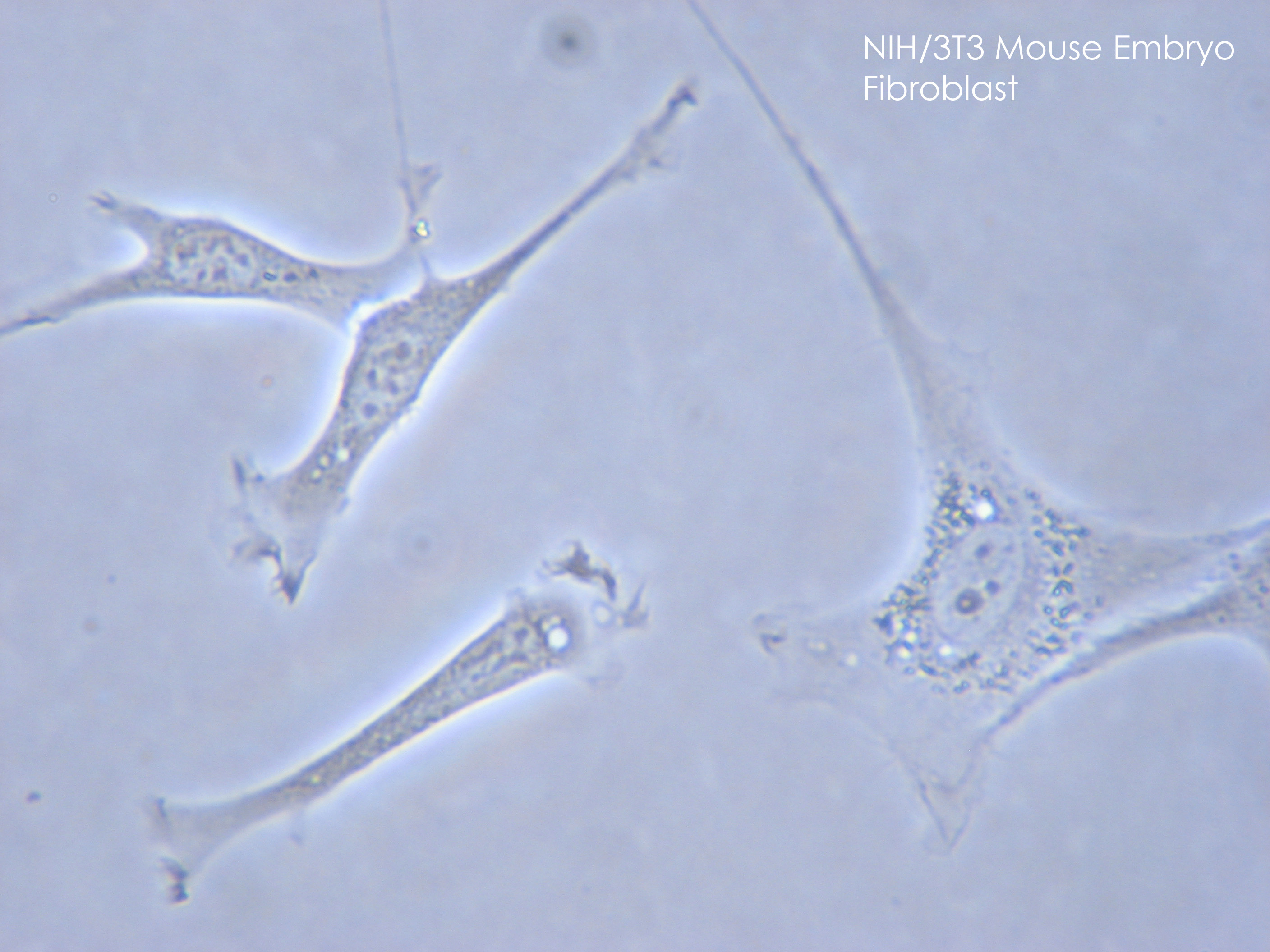 <p>Fibroblasts</p>