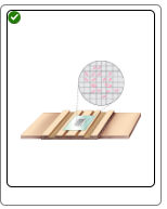 <p>Microscopic Count</p>
