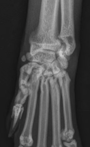 term image