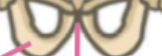 <p>What bone is this?</p>