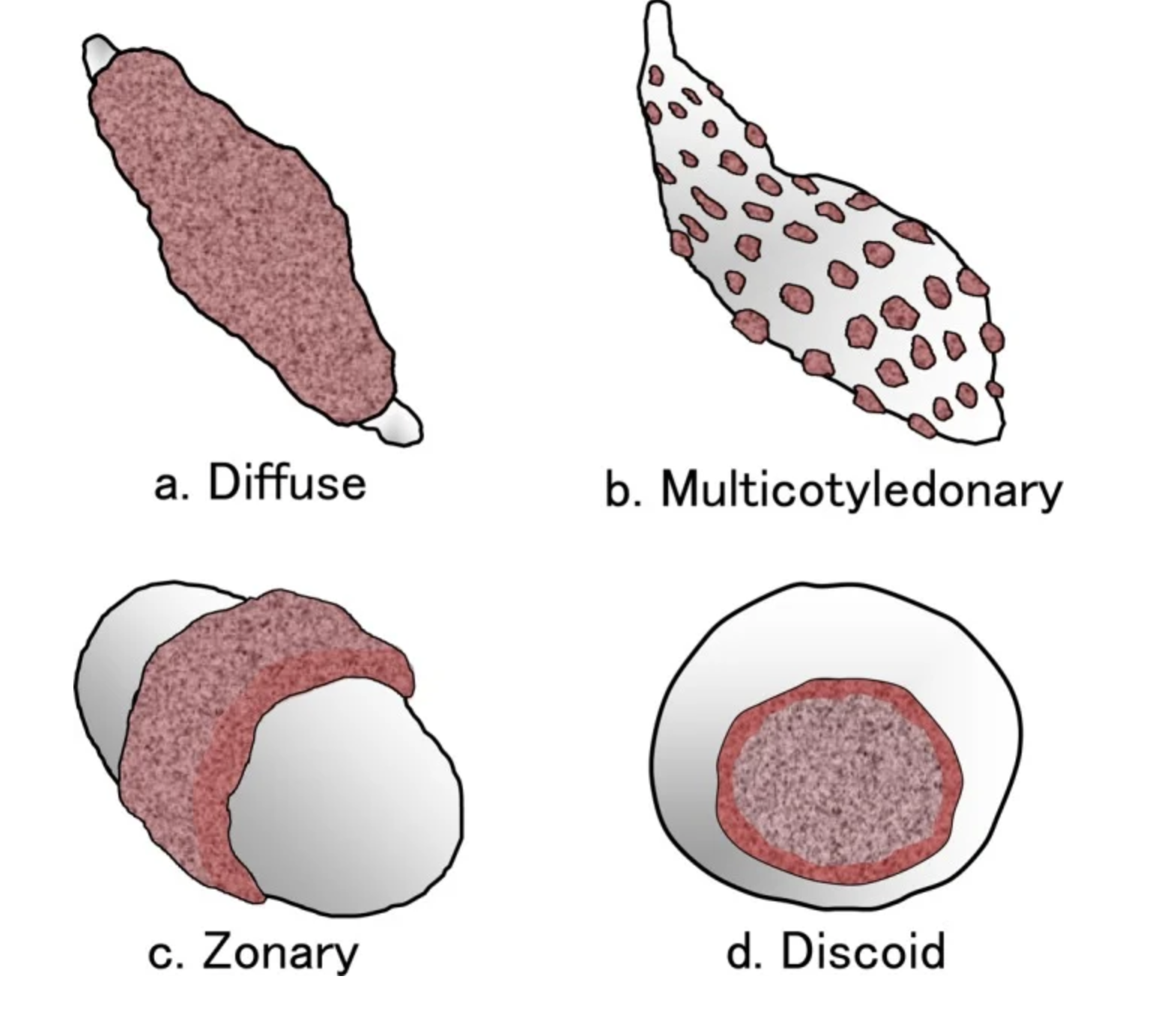<p>Cotyledonary Placenta</p><p>Zonary Placenta</p><p>Discoid Placenta</p><p>Diffuse Placenta</p>
