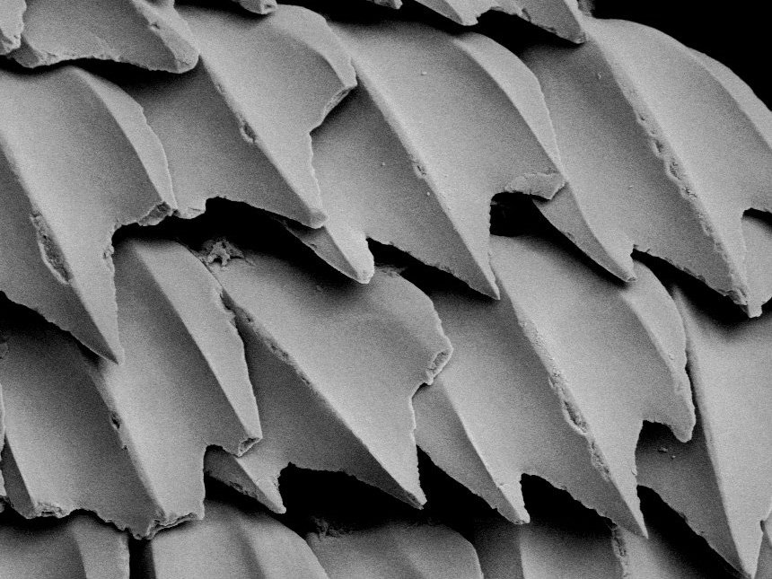 <p>Placoid Scales</p>