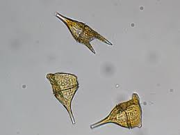 <ol><li><p>is this a protist or a bacteria?</p></li><li><p>what phylum?</p></li><li><p>what is their exterior made out of?</p></li></ol><p></p>