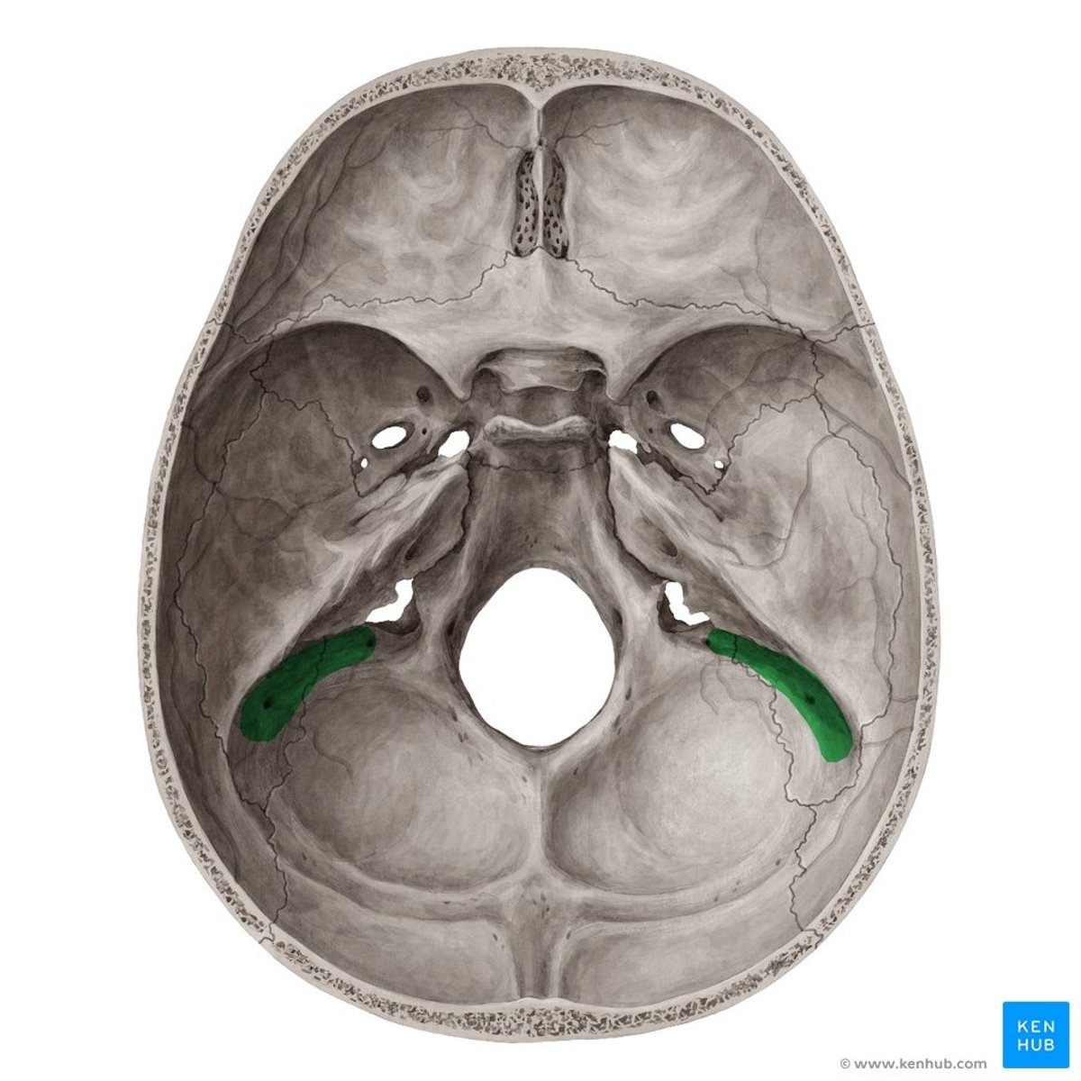 <p>What is this boney feature?</p>