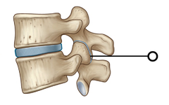 <p>What type of joint is the zygapophyseal joints (apophyseal or interarticular joints)?</p>