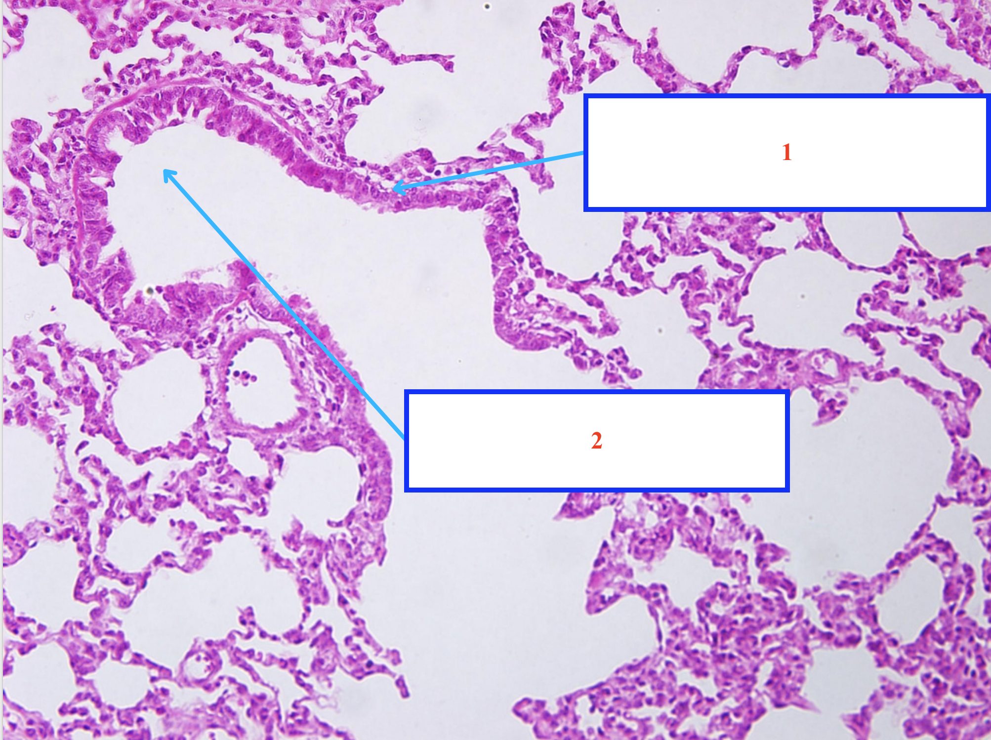 <ol><li><p>Cấu trúc gì ?</p></li><li><p>Cấu trúc gì ?</p></li></ol><p></p>