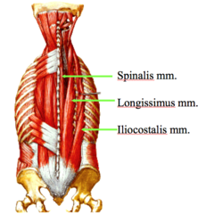 <p>Erector spinae group (I Love Spine- lateral to medial... 1st)</p>