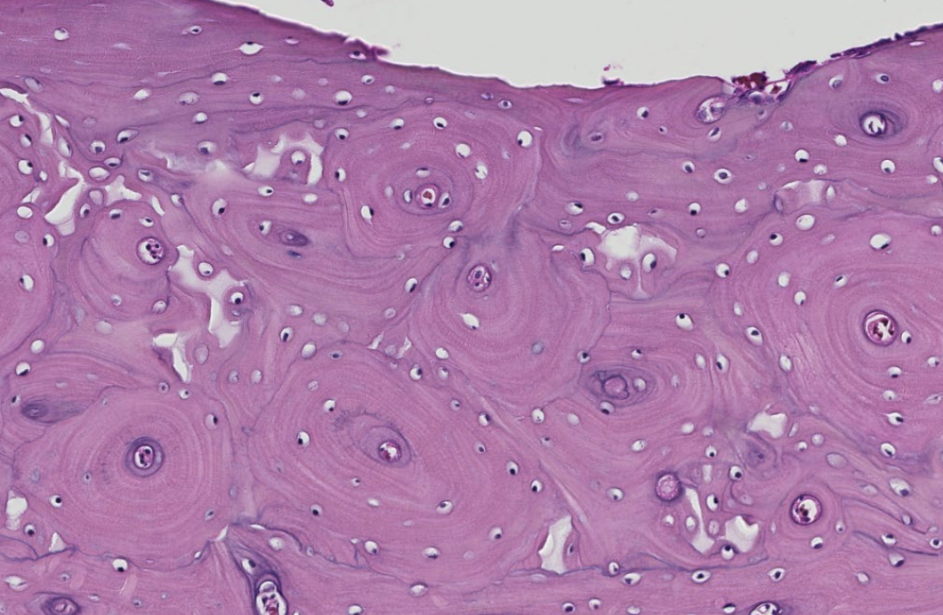 <p>ID the bone type shown in this H&E stain (transverse tissue section)</p>