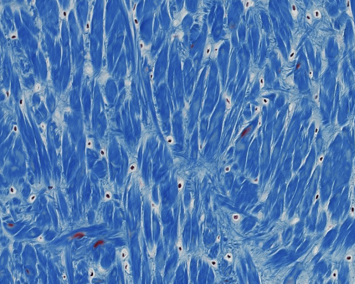 <p>fibrocartilage </p>